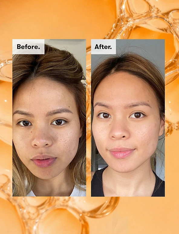 REN Cleansers & Toners Ready Steady Glow Daily AHA Tonic 250ml 5 REN Cleansers & Toners Ready Steady Glow Daily AHA Tonic 250ml - Image 5