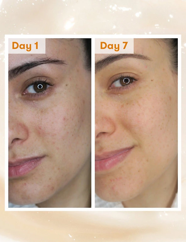 REN Face Cream Overnight Glow Dark Spot Sleeping Cream 50ml 9 REN Face Cream Overnight Glow Dark Spot Sleeping Cream 50ml - Image 9