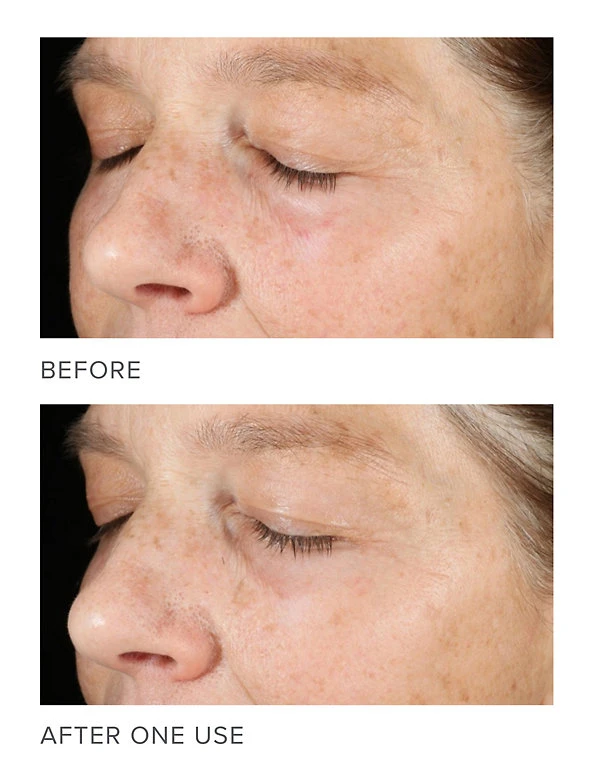 Murad® Cleansers & Toners Vita-C Exfoliating Facial 80ml 4 Murad® Cleansers & Toners Vita-C Exfoliating Facial 80ml - Image 4